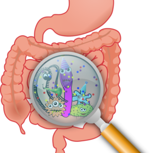 What You Need to Know About Irritable Bowel Syndrome