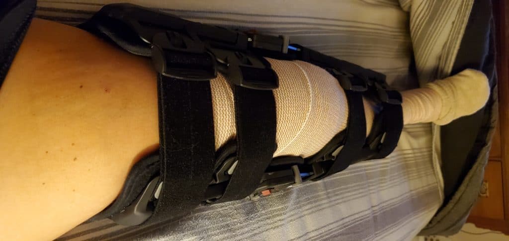 Leg Brace 